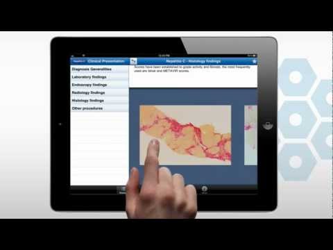 iLiver by EASL - The European Association for the Study of the Liver (EASL)