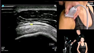 Session 2 – Diagnostic Shoulder Exams: Lateral Shoulder