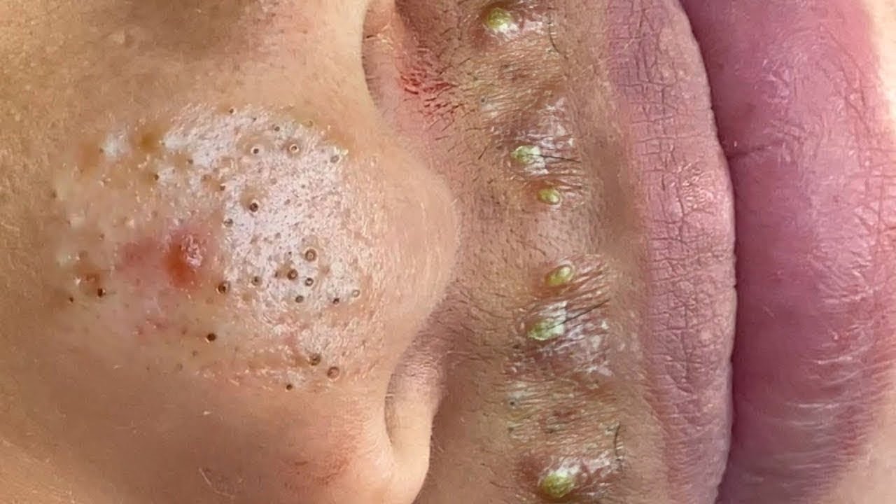 𝑺𝒐𝒐𝒕𝒉𝒊𝒏𝒈 𝑭𝒂𝒄𝒊𝒂𝒍 𝑻𝒓𝒆𝒂𝒕𝒎𝒆𝒏𝒕 𝑭𝒐𝒓 𝑺𝒕𝒓𝒆𝒔𝒔 𝑹𝒆𝒍𝒊𝒆𝒇 𝒂𝒕 𝑳𝒖𝒙𝒖𝒓𝒚 𝑺𝒑𝒂 𝑨𝒄𝒉𝒊𝒆𝒗𝒆 𝑰𝒏𝒏𝒆𝒓 𝑷𝒆𝒂𝒄𝒆 #500334