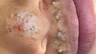 𝑺𝒐𝒐𝒕𝒉𝒊𝒏𝒈 𝑭𝒂𝒄𝒊𝒂𝒍 𝑻𝒓𝒆𝒂𝒕𝒎𝒆𝒏𝒕 𝑭𝒐𝒓 𝑺𝒕𝒓𝒆𝒔𝒔 𝑹𝒆𝒍𝒊𝒆𝒇 𝒂𝒕 𝑳𝒖𝒙𝒖𝒓𝒚 𝑺𝒑𝒂 𝑨𝒄𝒉𝒊𝒆𝒗𝒆 𝑰𝒏𝒏𝒆𝒓 𝑷𝒆𝒂𝒄𝒆 #500334