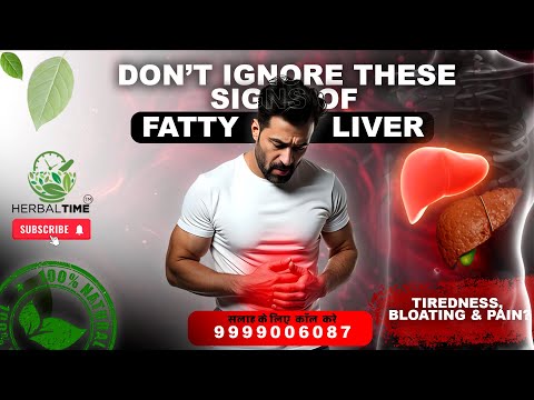 HERBAL TIME FATTY LIVER