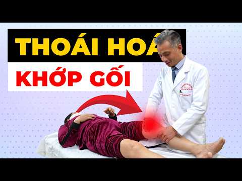 TRIỆU CHỨNG: Thoái hóa khớp gối – Khi nào THẬT SỰ nên thay khớp