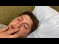 My Brothers Wisdom Teeth Video Wisdomteethremoval Brother