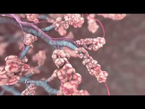 Cadila Pharmaceuticals Mycidac-C for the treatment of Non-Small Cell Lung Cancer