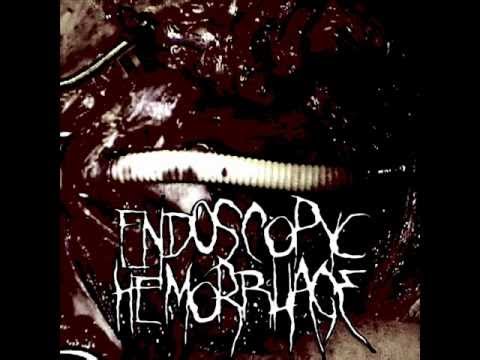 Endoscopyc Hemorrhage - Bizarre Thoughts Horrificly Conceived (alternate version)