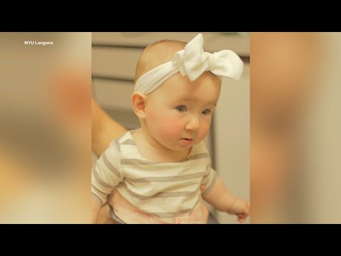 Baby's cleft palate fixed after successful jaw surgery at NYU Langone