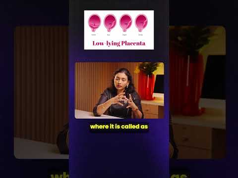 Low-Lying Placenta Explained in Simple Terms | Dr. Priya Kalyani