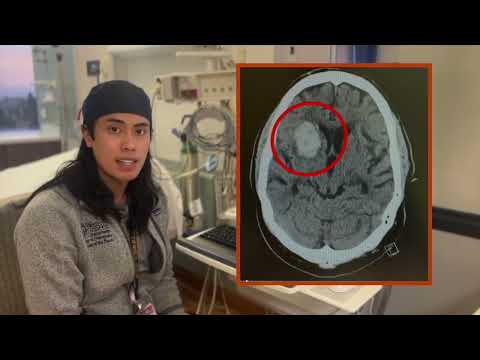 This is How We Do It: How to Read a Head CT