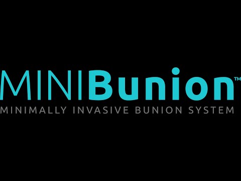 MINIBunion: MIS Bunion System FAQ - "How fast can I return to activity?"