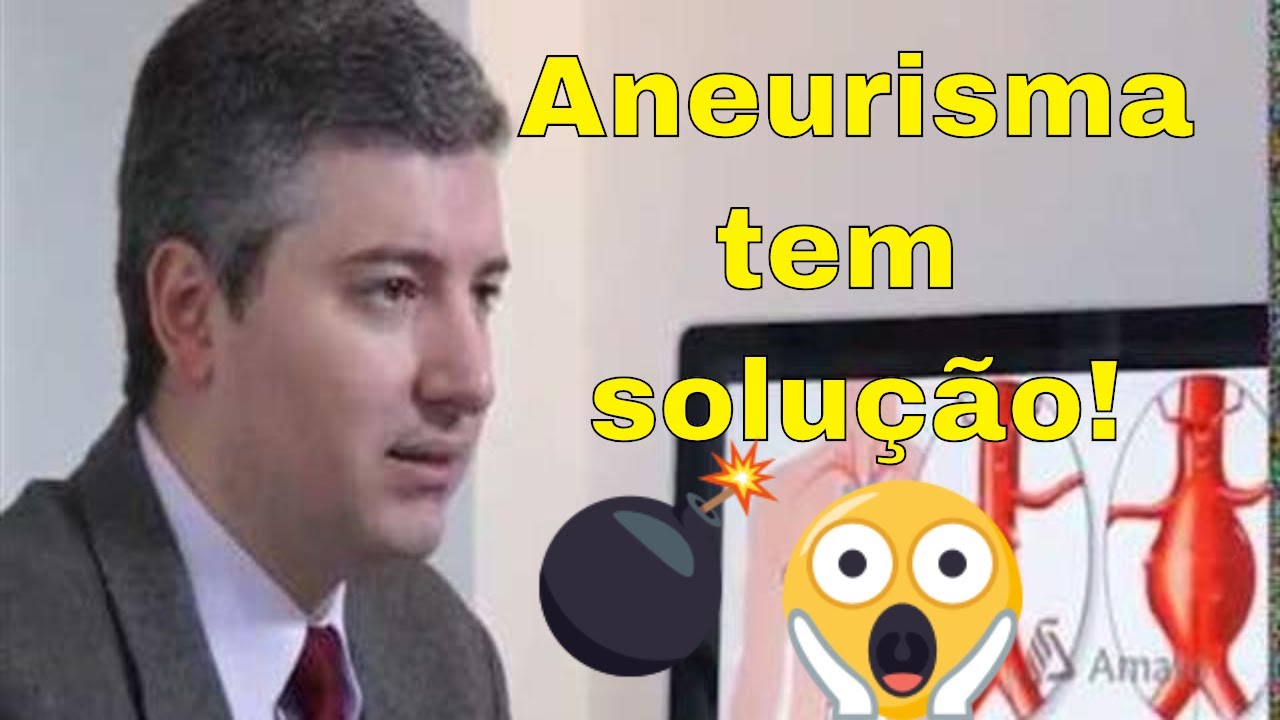 Aneurismas de Aorta: Dr. Alexandre Amato