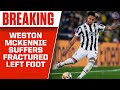 Juventus and USMNT Midfielder, Weston McKennie Suffers Fractured Left Foot | CBS Sports HQ