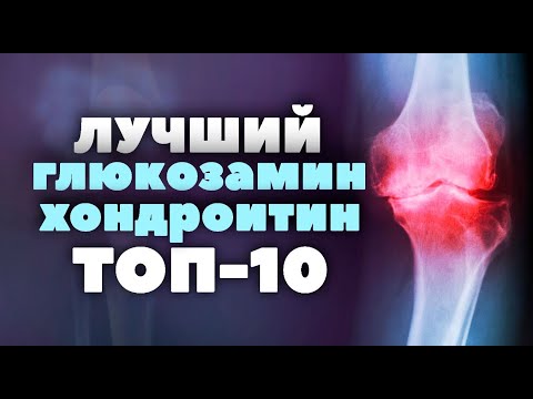 fájó karpális ízületi kúpok fájdalom ízületi műtét után