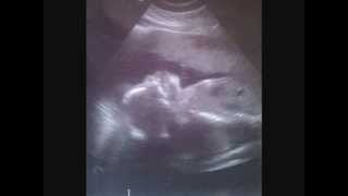 I Feel For You (Featuring AZ)