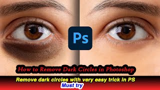 how to remove dark circles using photoshop|skin retouching|remove eye bags Photoshop