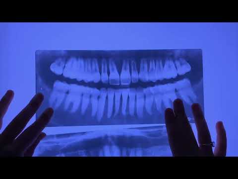 Slide 3 - Dental X-Rays, Set of 10 (video)