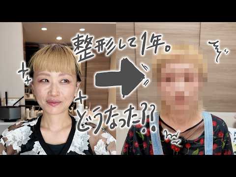 【告白】整形から1年経った顔面はどうなったのか。【ロシアン佐藤】【RussianSato】