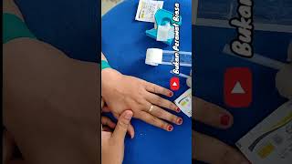 Download lagu how to install an infusion, the vein is visible mp3 Download lagu how to install an infusion, the vein is visible mp3