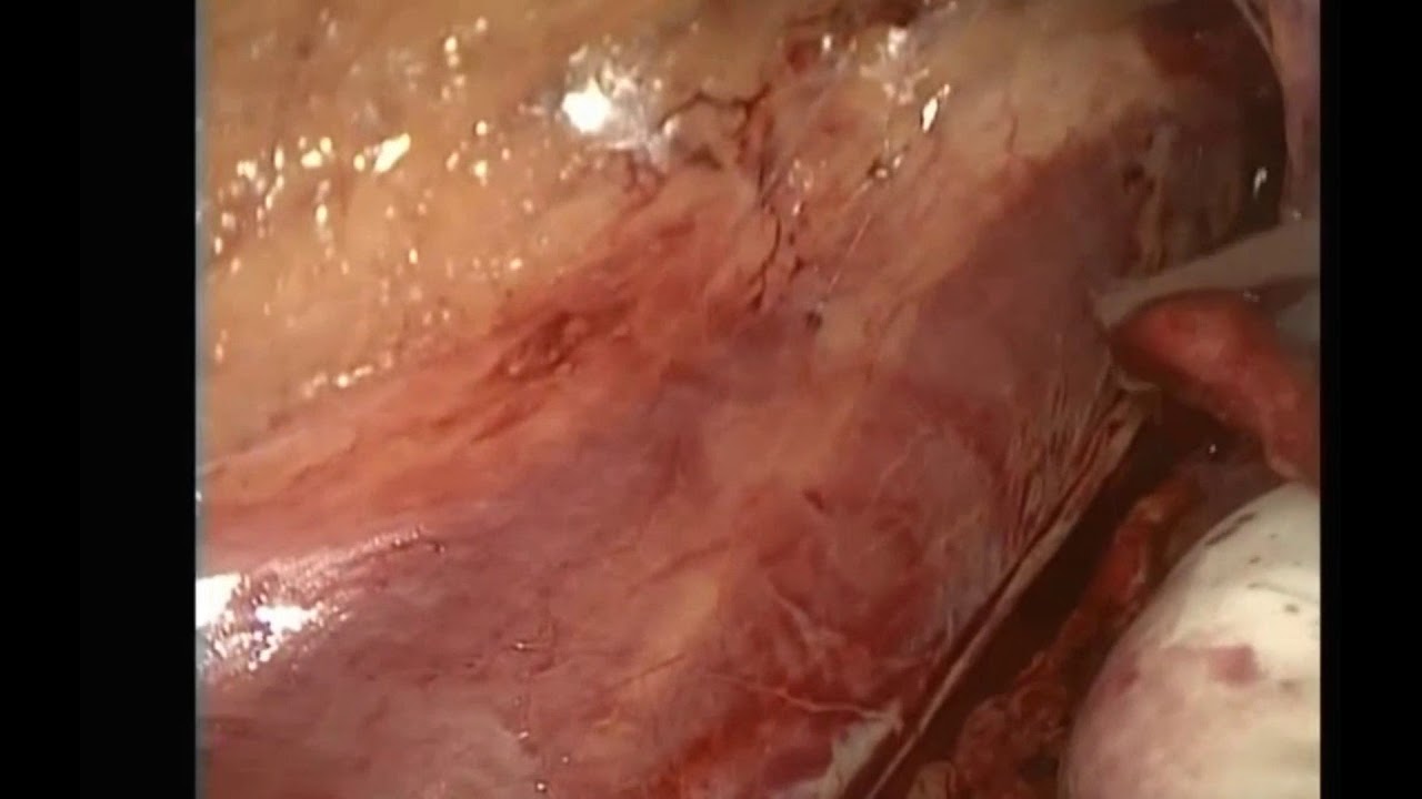 Alfonso José Fernández Carreño-6