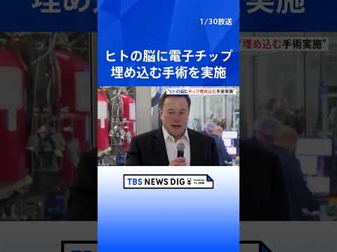 テレコムはデッドスポットに終止符を打ちたいと考えている - イーロン・マスク氏も協力すべきだ