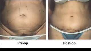 Eisemann Plastic Surgery Center