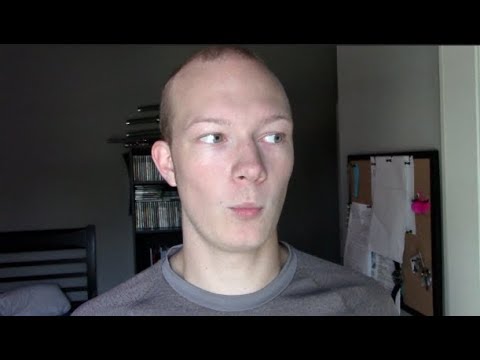 19 Year Old Balding - Dealing With Criticism
