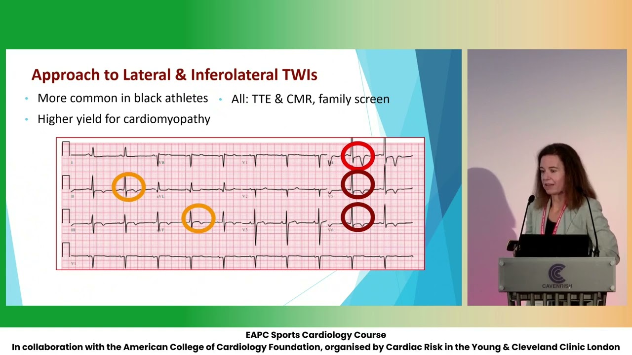 When to investigate T wave inversions - M  Wasfy
