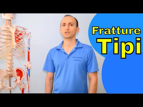 What are the Types of Fractures? How to Recognize Them? (The Complete Guide)
