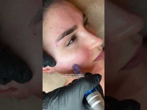 Santé Clínica Estética Barcelona