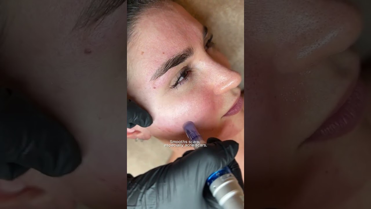 Santé Clínica Estética Barcelona