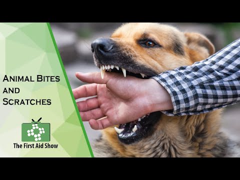 Animal Bites and Scratches - YouTube