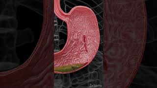 When your Stomach bleeds!  #anatomy #animation