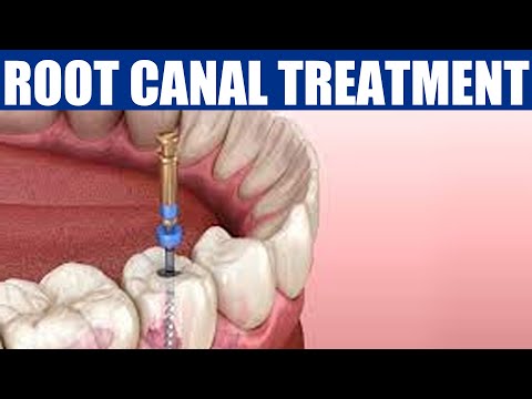 dental care problems explain by Dr.Prasad from Kims detnal care
