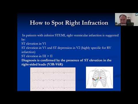 Atypical is Typical Chest Pain - An ED Perspective