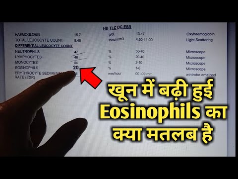 Eosinophils high in blood test means, eosinophilia, High Eosinophils, cbc Blood test in hindi