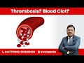 All you need to know about Thrombosis and Blood Clot (100% accurate) | By Dr. Bimal Chhajer | SAAOL