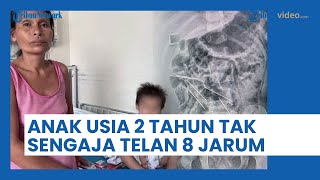 Mimpi Buruk Seorang Ibu, Anak 2 Tahun di Peru Ini Tak Sengaja Telan 8 Jarum Suntik di Peternakan