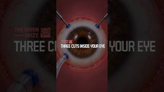 Three Cuts Inside Your Eye