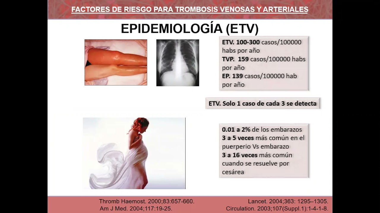 Trombofilia Primaria y Secundaria