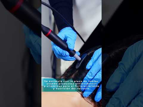 FORTALECE tu cabello con el INDIBA CAPILAR ‼️