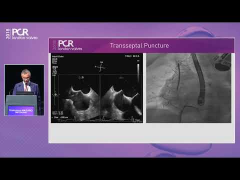 MitraClip NTR and XTR: more options, more possibilities