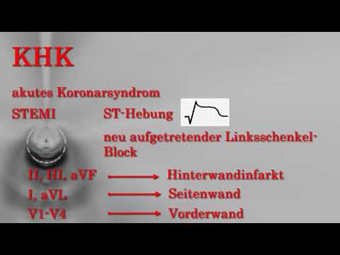 Vorbereitung für Approbationsprüfung (KP) 1.Kardiologie Koronare Herzkrankheit KHK