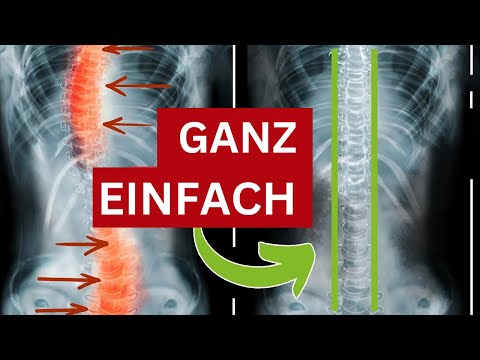 Wirbelsäule stabilisieren mit nur 1 Übung