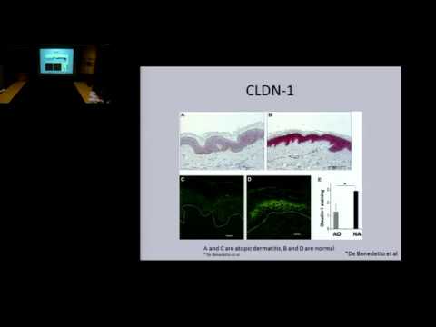 05/12/15 Skin Barrier & Immune Dysregulation in Atopic Dermatitis