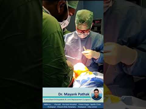 Knee Replacement Guide by Dr. Mayank Pathak