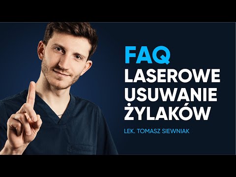 Laserowe usuwanie żylaków - najczęstsze pytania (odpowiada lek. Tomasz Siewniak)