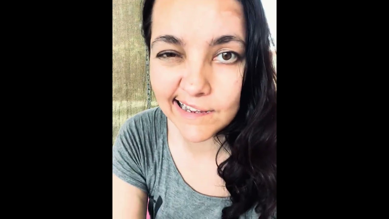 My Bell’s palsy journey