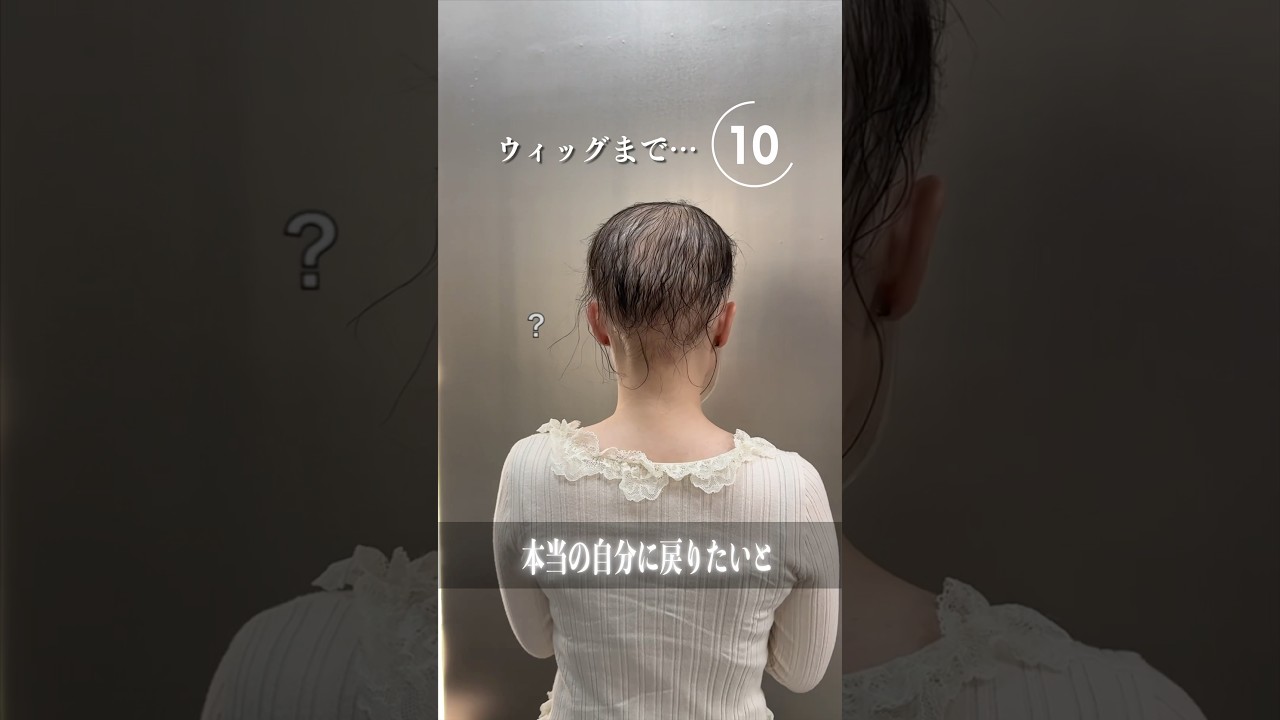脱毛症の私が探し続けていた私がこれ。#ウィッグ #脱毛症 #wig #alopecia #가발