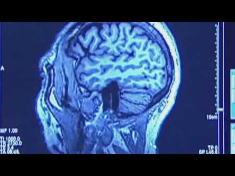 Free Conference on Alzheimer’s