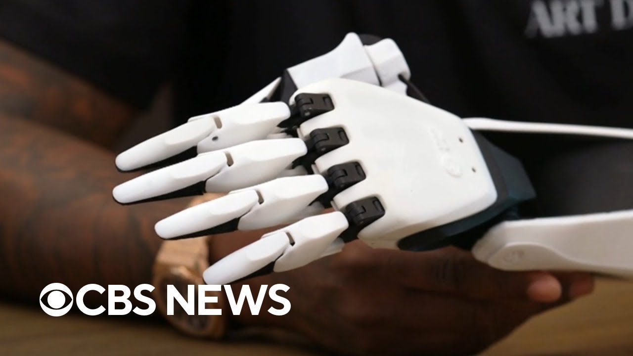 CBS News covers smartARM