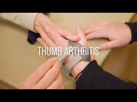 Thumb Arthritis Symptoms, Causes, and Treatment